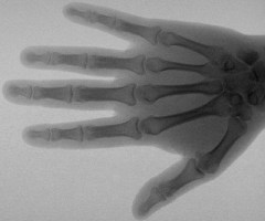 8 ноября были открыты «рентгеновские лучи» - Календарик - Спецпредложение |  Золото Уссурийска